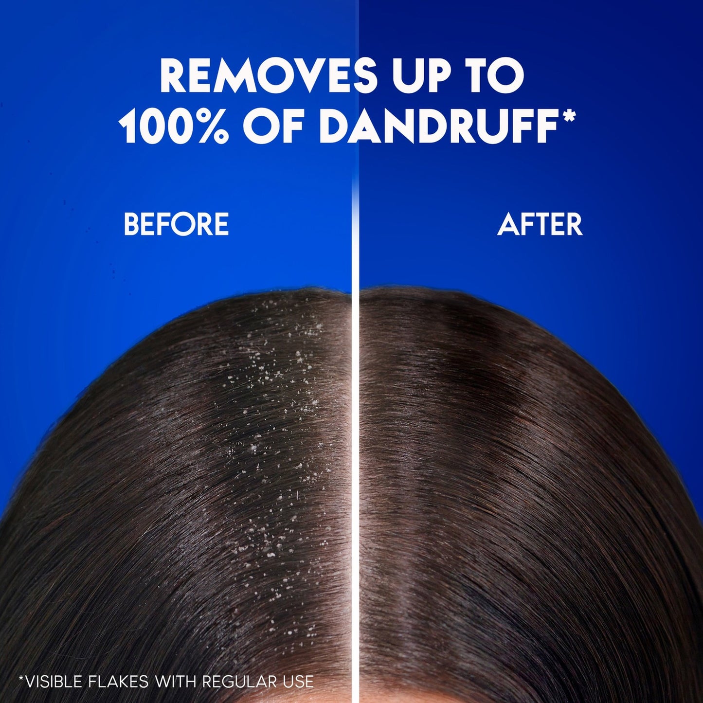 Head & Shoulders Extra Volume