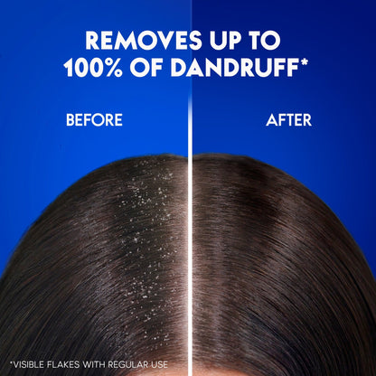 Head & Shoulders Extra Volume
