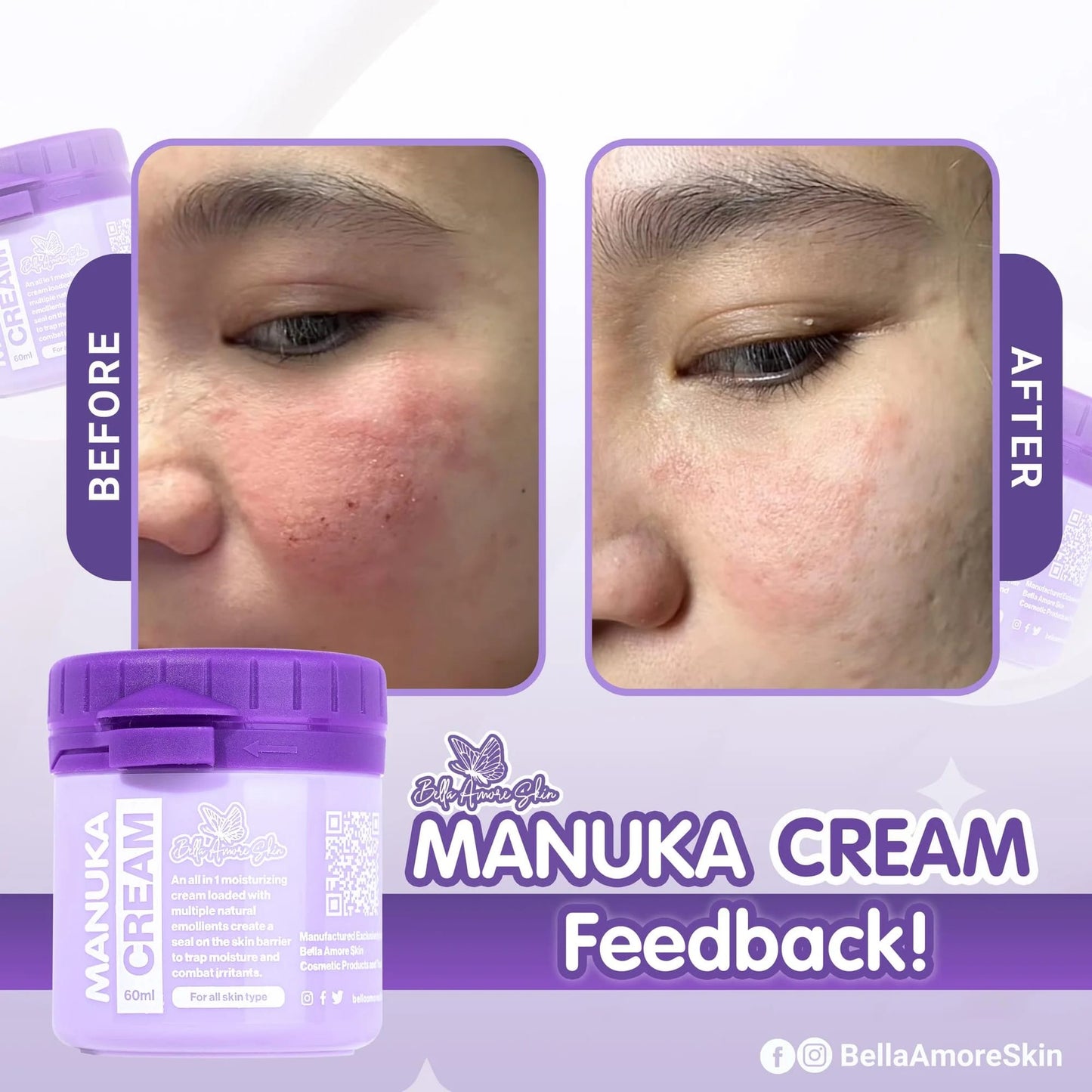 Manuka Cream