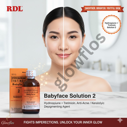 Rdl Babyface no # 2