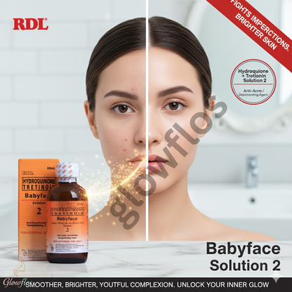 Rdl Babyface no # 2