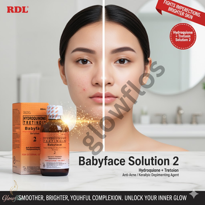 Rdl Babyface no # 2